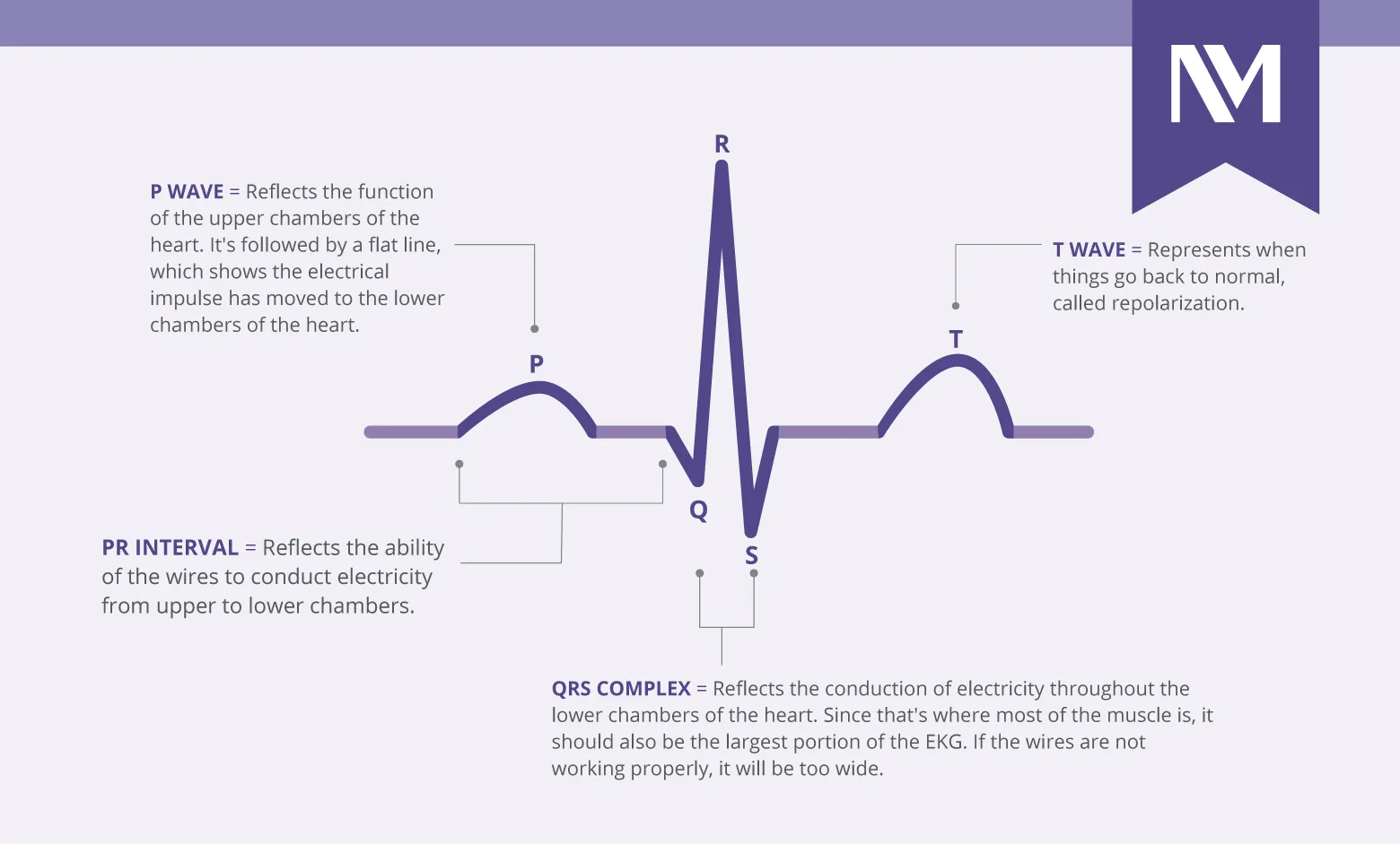 ECG Waveform